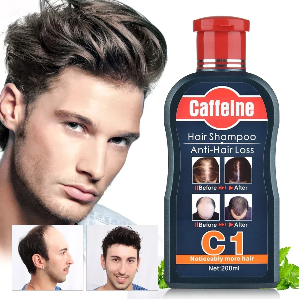 Hair Care Korean Products - Men Shampoo For Hair Growth Natural