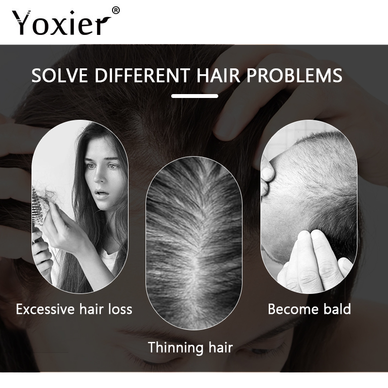 Intensive Growth Serum Prevent - Hair Care For Hair Loss ulasan dan harga
