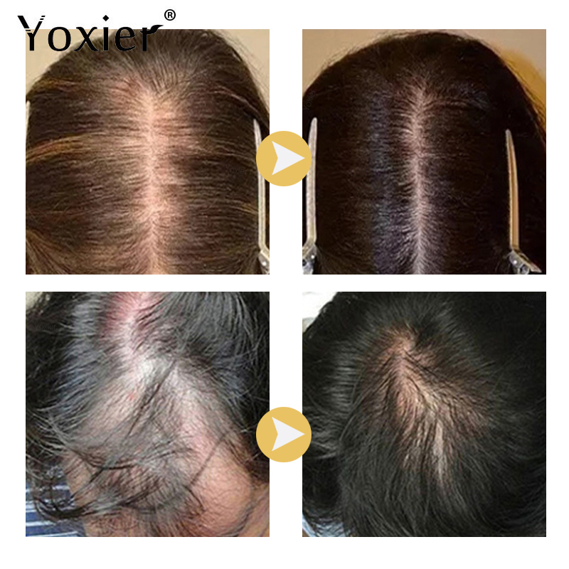 Intensive Growth Serum Prevent - Hair Care For Hair Loss ulasan dan harga