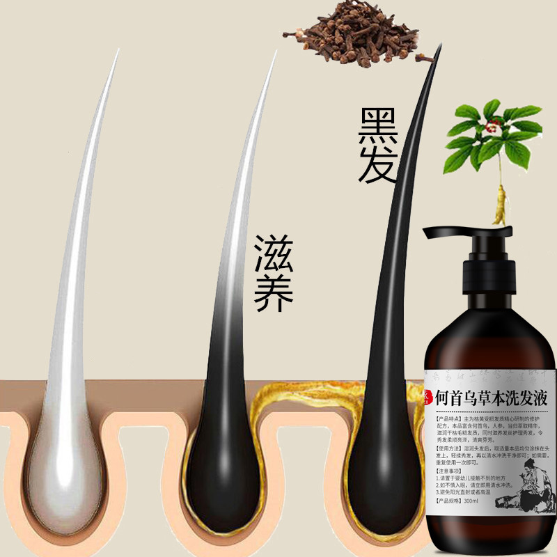 300ml Polygonum multiflorum sh - Hair Care Herbal ulasan dan harga