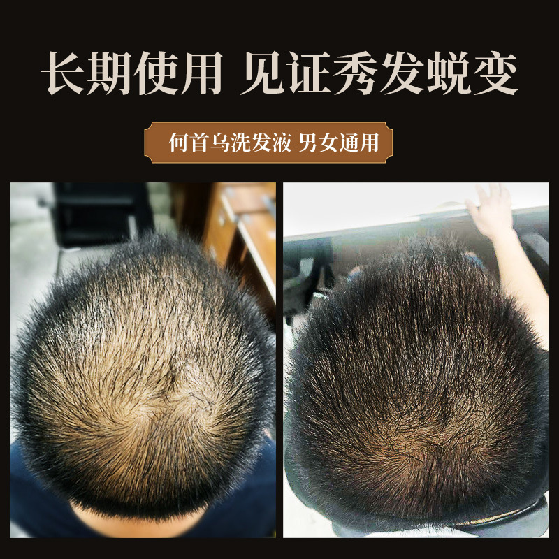 300ml Polygonum multiflorum sh - Hair Care Herbal ulasan dan harga