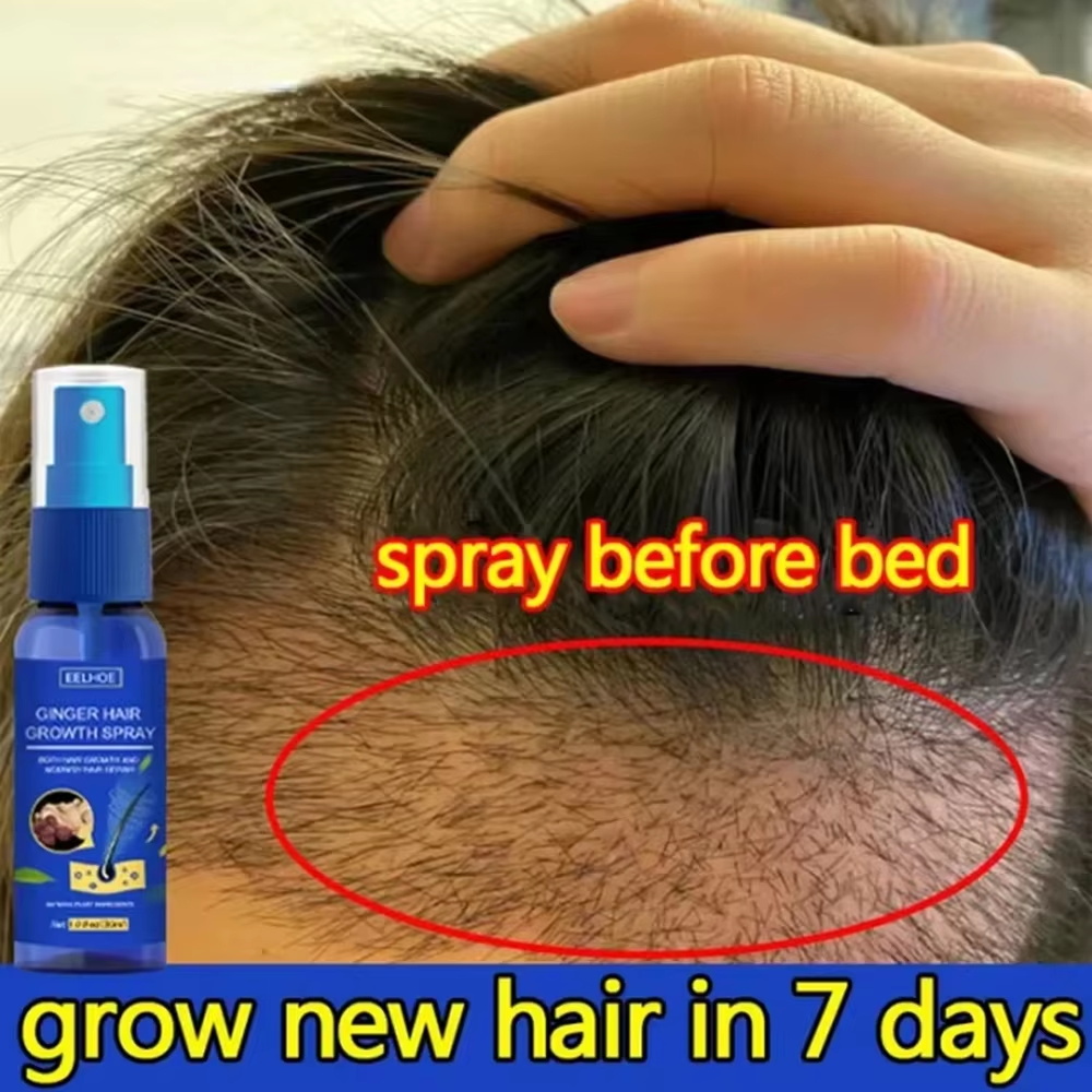 Fast Ginger Hair Growth Spray  - Hair Care For Hair Loss ulasan dan harga