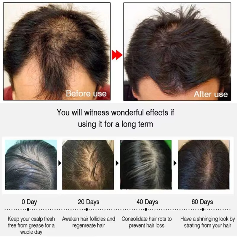 Fast Ginger Hair Growth Spray  - Hair Care For Hair Loss ulasan dan harga