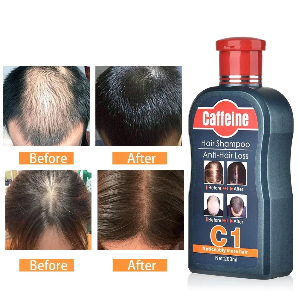 Men Shampoo For Hair Growth Na - Hair Care Korean Products ulasan dan harga